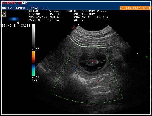 Heute am 23.01.2015 waren wir mit Scrabble zum Ultraschall.