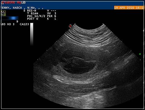 Am 27. Tag waren wir zum Ultraschall.