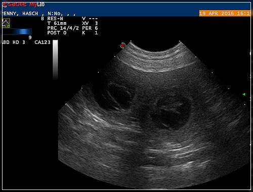 Am 27.Tag waren wir zum Ultraschall.
