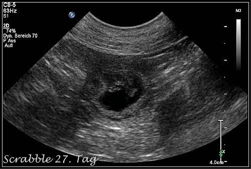 15.09.2017waren wir zum Ultraschall